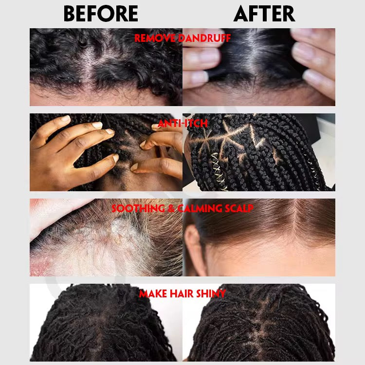Scalp Anti Itch oil