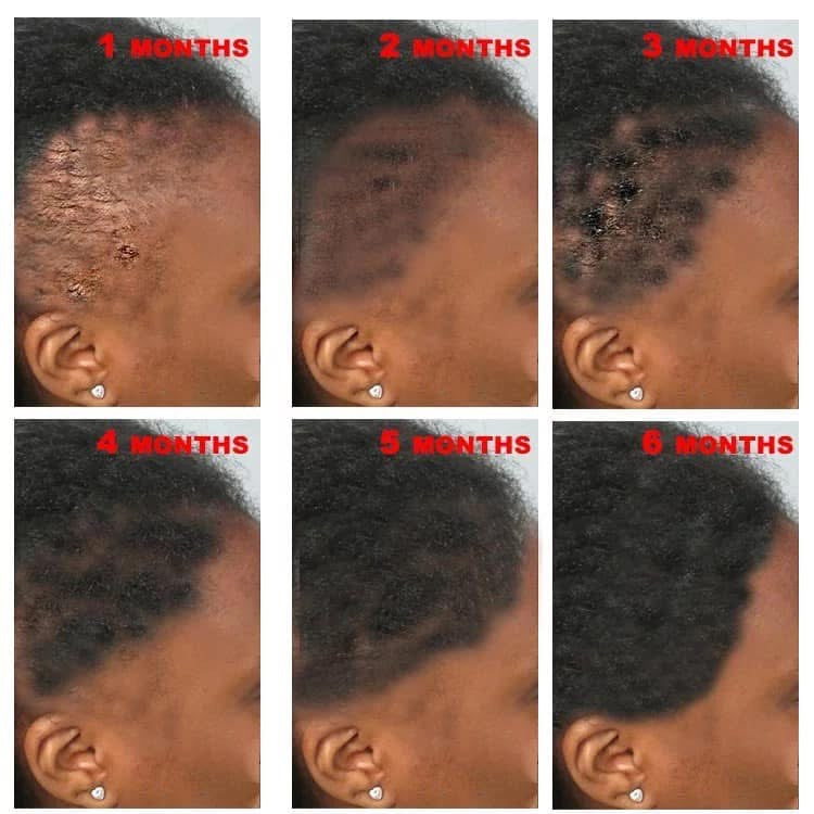 Hair Growth cream
